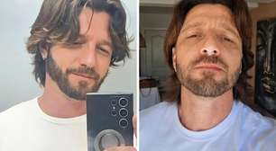Pânico e sangue: ex-Malhação Diogo Venturieri relata acidente com piercing na 'Hora H'
