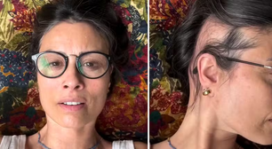 Apresentadora mostra falhas no cabelo e comove fãs ao relatar doença autoimune