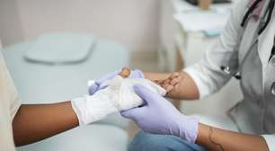 Casos de queimaduras crescem 16% no Brasil: saiba como agir