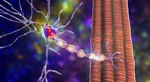Cientistas holandeses descobrem como células de defesa do cérebro podem acabar agravando a esclerose múltipla