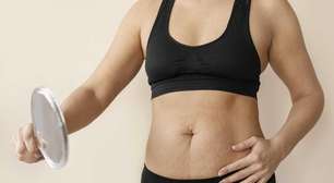Como tratar a flacidez da pele após emagrecer