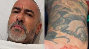Henrique Fogaça ressurge após acidente e apavora fãs com machucados: 'Foi brutal'