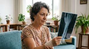 Osteoporose ou outra doença? Nem toda fragilidade óssea tem a mesma causa