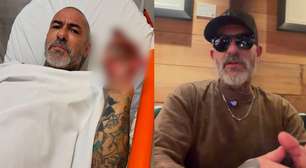 Após ausência no MasterChef, Henrique Fogaça fala sobre acidente de moto: 'Eu não morri por Deus'