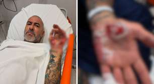 Henrique Fogaça relata que acidente de moto e afirma que teve aliança roubada em hospital