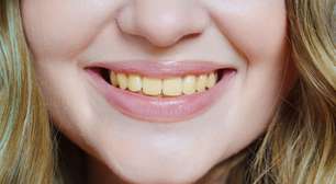Tem dentes amarelados? Conheça hábitos que escurecem o sorriso