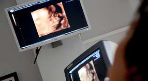 Pesquisa reforça técnica fetal para hérnia diafragmática