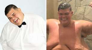 De cueca, Gordão da Xj mostra excesso de pele após perder 130 kg; veja fotos