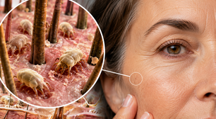 Todo mundo os tem no rosto: pesquisas revelam que os ácaros dos poros estão passando de uma relação parasitária para uma simbiótica