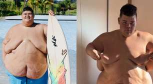 De 350 kg para 220 kg: influenciador Gordão da XJ choca web ao compartilhar antes e depois do corpo após perder 130 kg; veja a transformação em 20 fotos!