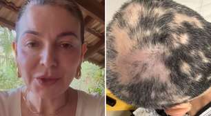 Mãe de Lucas Lucco mostra recaída de diagnóstico severo: 'Fiquei mais triste agora'