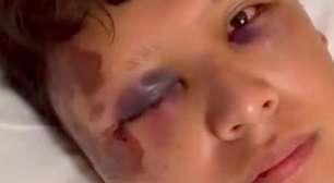 Turista mexicano é agredido com garrafada na cabeça em Copacabana