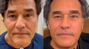 Luciano Szafir revela harmonização facial aos 57 anos e surpreende pela naturalidade