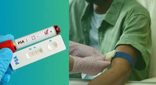 PSA alto nem sempre é câncer: veja o que o exame de sangue para próstata realmente mostra
