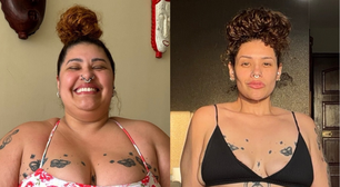 Ex-participante do The Voice Brasil mostra antes e depois de perder 90 kg com cirurgia bariátrica