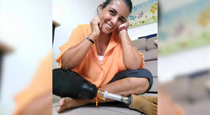 Sobreviveu a um trem, a uma picada de cobra e a mais de 30 cirurgias; agora, Fabiana faz vakinha para continuar andando