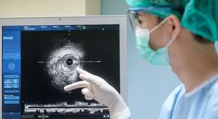 Cateterismo cardíaco: exame, cirurgia ou os dois?