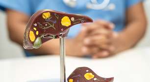 Aumentos precoces de glucagon no diabetes tipo 2 estão ligados à esteatose hepática