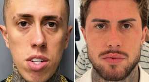 Além de MC Daniel, outros homens famosos que fizeram harmonização; veja os antes e depois