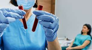 Jejum para exame de sangue: por que nem sempre são 8 ou 12 horas?