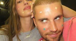 Adesivos para espinhas: tendência pop que une skincare e estilo