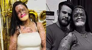 LUTO! Influenciadora morre aos 31 anos após batalha contra doença rara