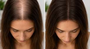 Seu cabelo parece não crescer? Veja o que realmente faz diferença