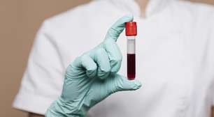 O que significa sonhar com sangue? Descubra os diferentes significados