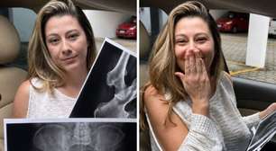 Influenciadora se espanta ao receber radiografias de partes íntimas: 'Nunca vi algo parecido'