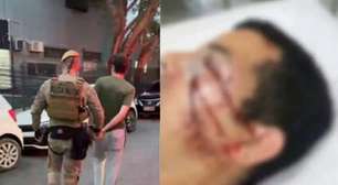 Polícia prende suspeito de ataque homofóbico que espancou e roubou vendedor em Florianópolis