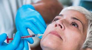 "Rosto de Ozempic"? Tratamento ou cirurgia resolve o problema