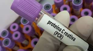 Proteína C reativa alta significa doença? O que o exame de PCR realmente mostra