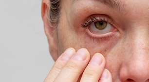 Olhos secos na menopausa? Alterações hormonais podem explicar o problema