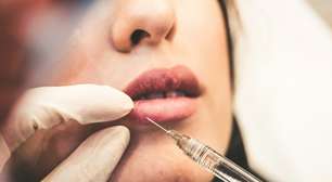 Bioestimulador x Preenchimento: qual a diferença e como escolher?