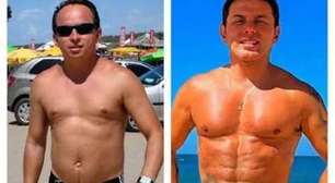 Marido de Gretchen impressiona com antes e depois após procedimentos estéticos
