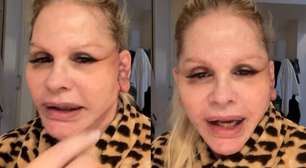 Monique Evans revela problema com reconhecimento facial de banco após cirurgia no rosto