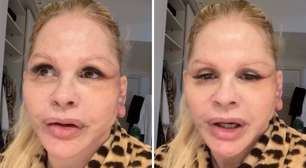 Monique Evans revela problema com reconhecimento facial de banco após cirurgia no rosto