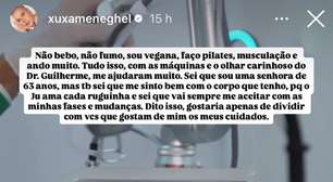 Laser de CO2 Neoxel ganha destaque com Xuxa