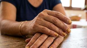 Unhas amareladas: veja as causas que vão além do esmalte