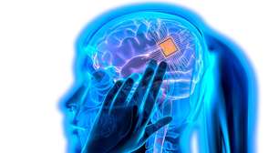 Implante cerebral chinês NEO marca uma nova era na medicina