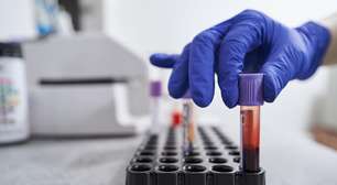 Exames de sangue podem prever o início dos sintomas de Alzheimer com anos de antecedência