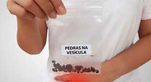 5 sinais de pedra na vesícula que podem começar com uma dor comum