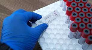 Sífilis: doença prevenível volta a crescer e preocupa especialistas no mundo todo