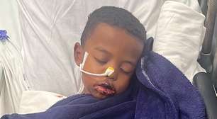 A luta de uma mãe para salvar Enzo Gabriel da Síndrome de Stevens-Johnson