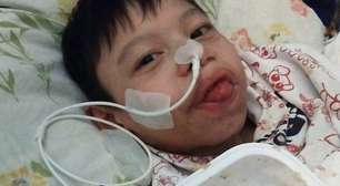Uma cirurgia para Nathan: esperança em meio à luta contra a desnutrição