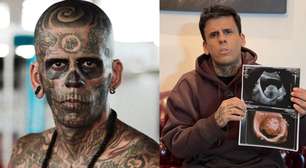 Após diagnóstico de insuficiência renal, 'homem mais tatuado do Brasil' descobre tumor na bexiga