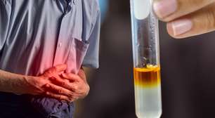 Amilase alta significa pancreatite? O que o exame realmente pode indicar