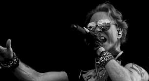 Axl Rose revela diagnóstico de ATM e descreve fortes dores na mandíbula