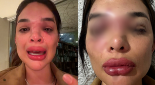 Mulher denuncia agressões e empresário é preso em flagrante em SP: 'Acabou o silêncio'