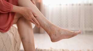 Semana Nacional da Saúde Vascular: saiba como prevenir doenças